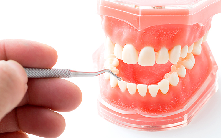 一般的な歯科治療